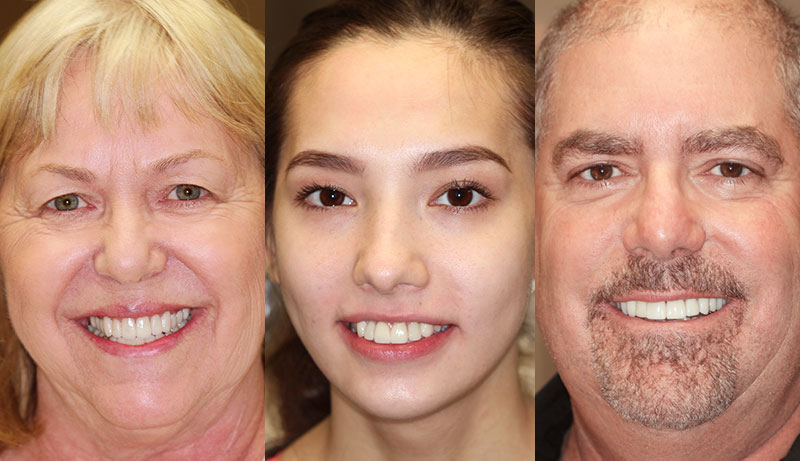 Happy Veneers Patients
